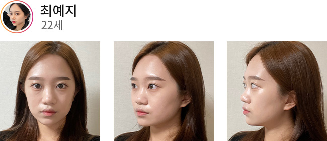 이미지01