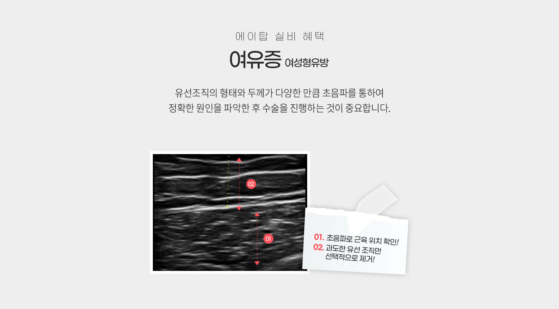 실비혜택안내