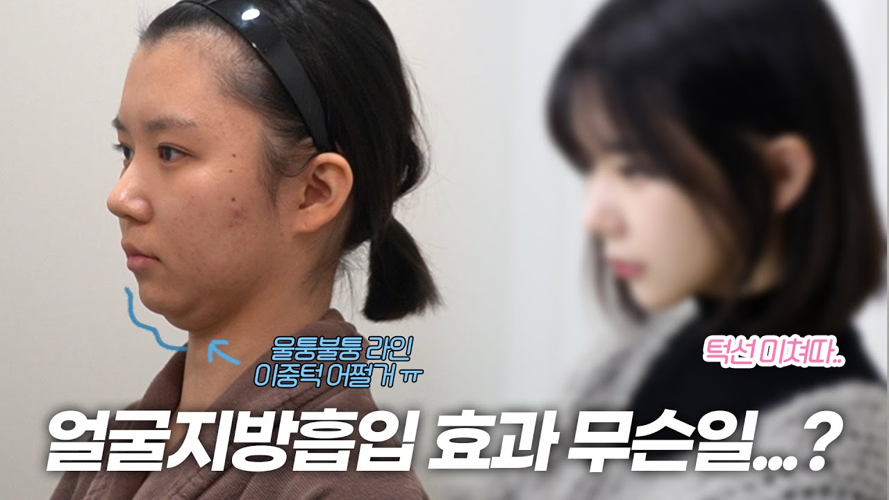 유튜브썸네일3