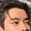 남자성형프로모션 탭메뉴_이마