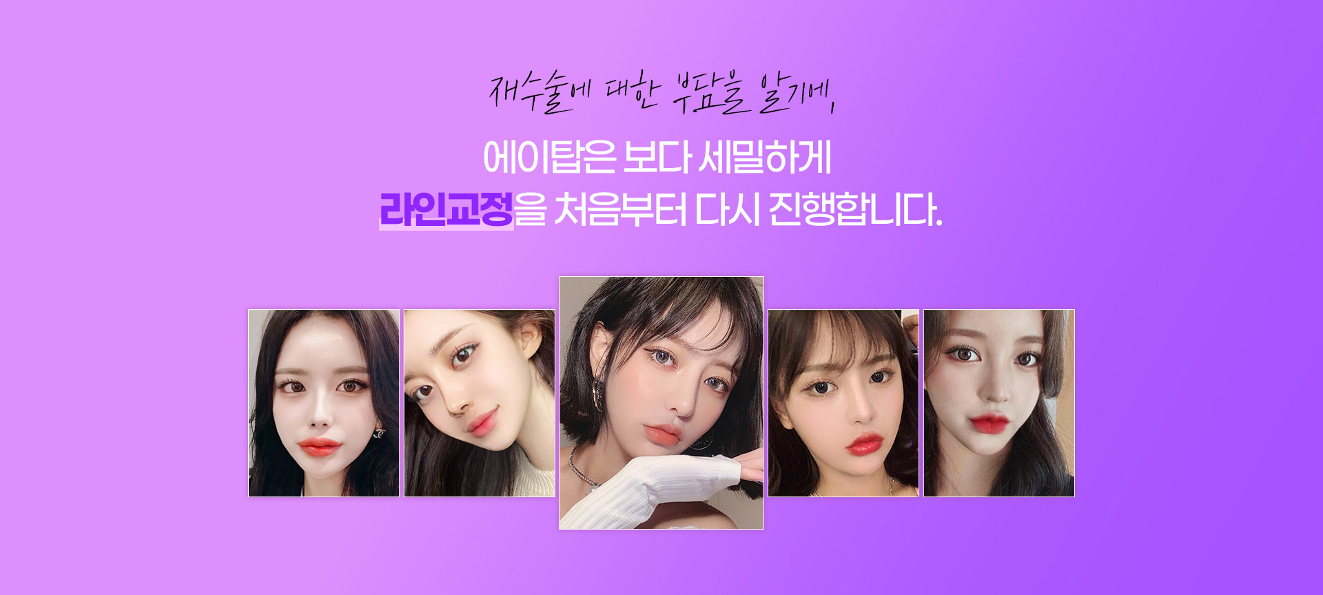 눈재수술