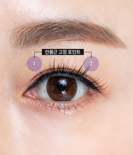 상안검성형