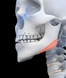시그니처 윤곽패키지