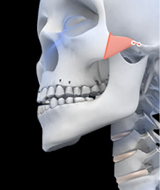 시그니처 윤곽패키지