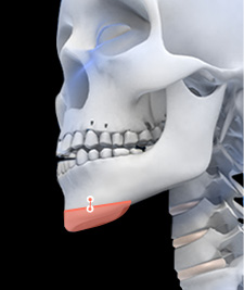 시그니처 윤곽패키지