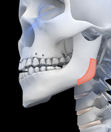 시그니처 윤곽패키지