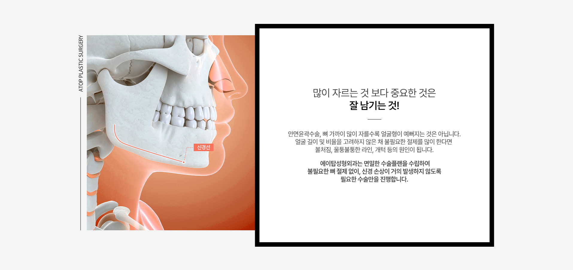 시그니처 윤곽패키지