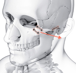 시그니처 윤곽패키지