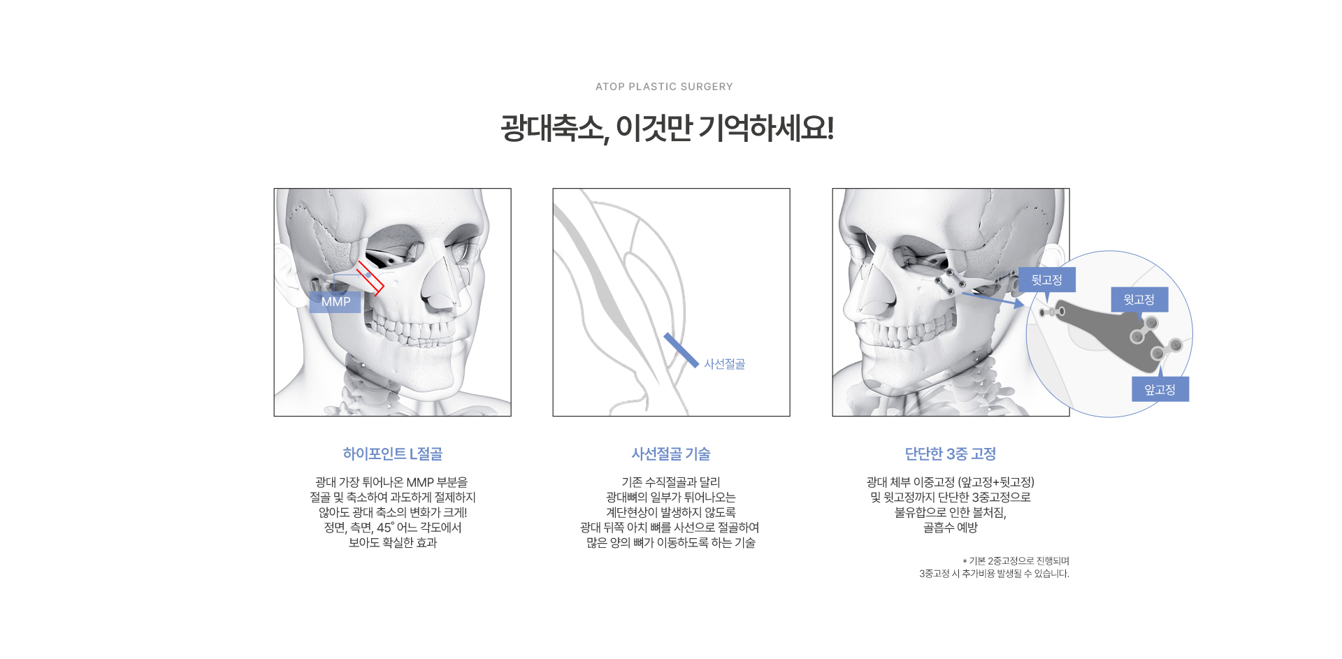 광대축소