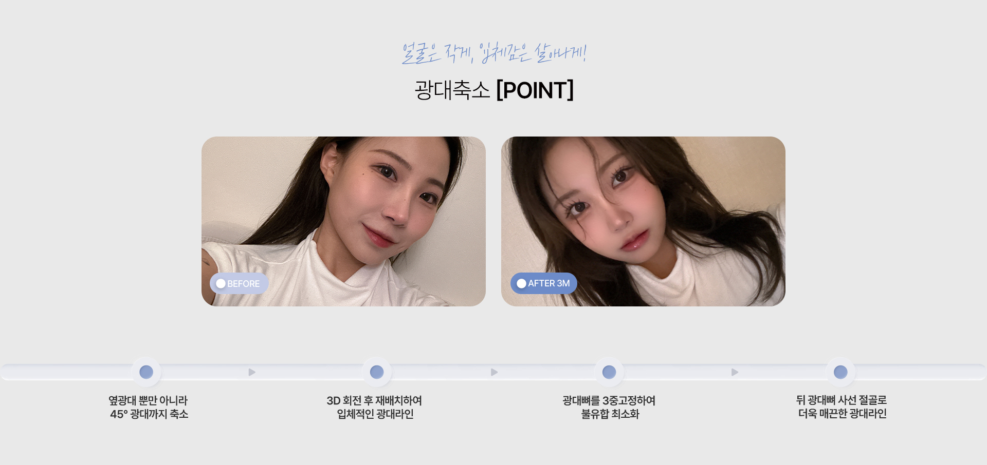 광대축소