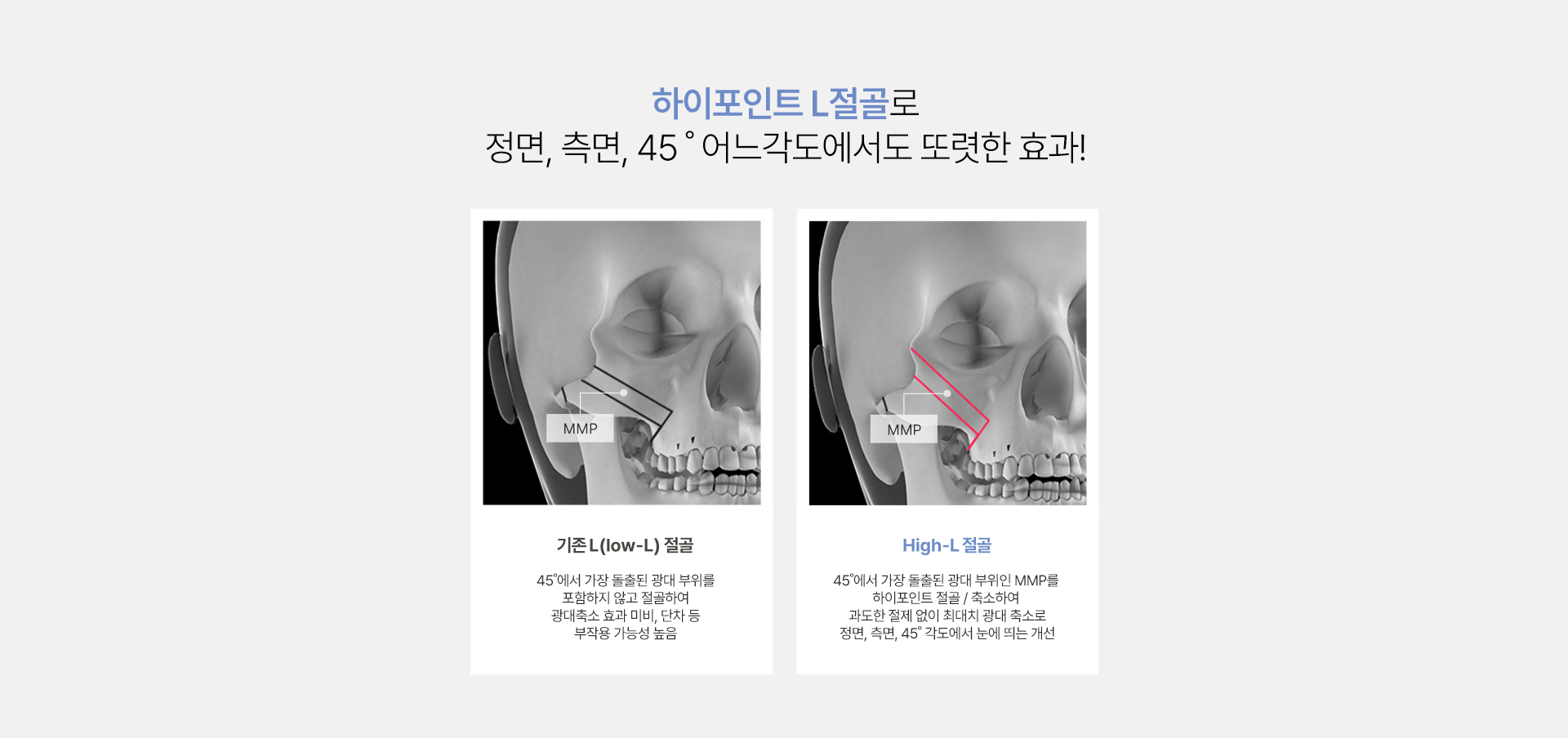 광대축소