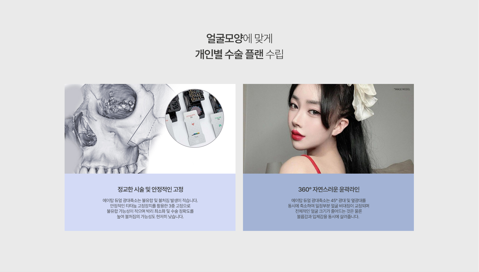 광대축소