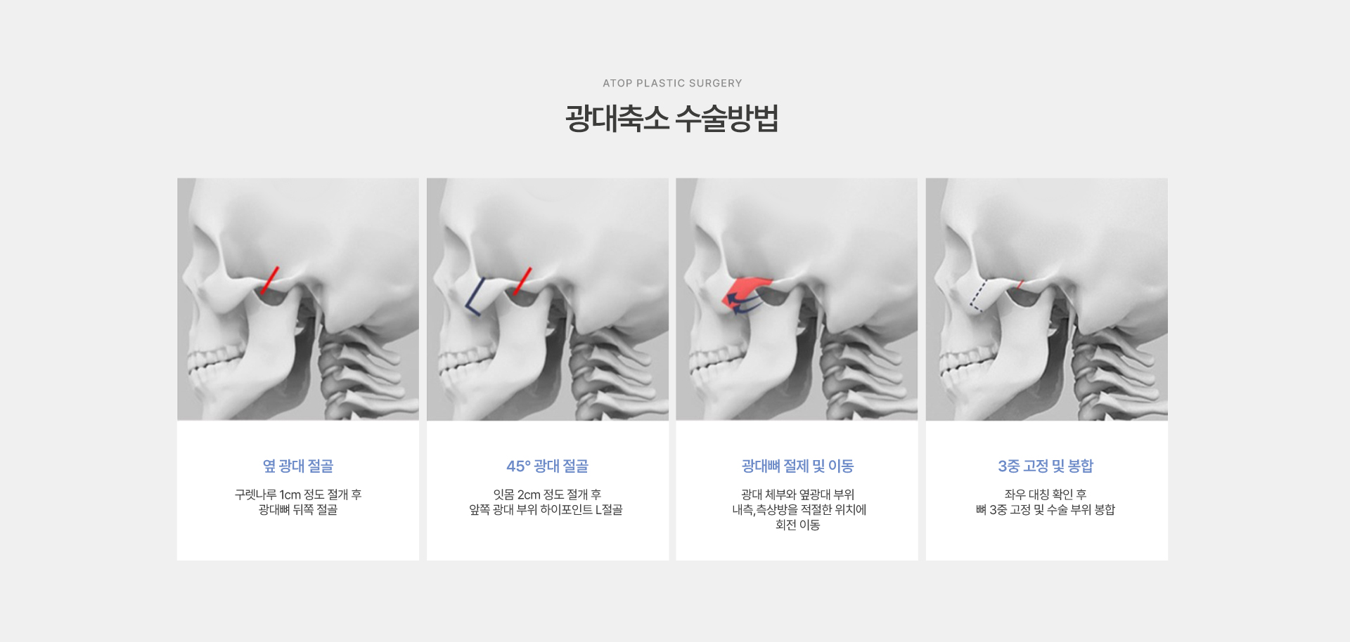 광대축소