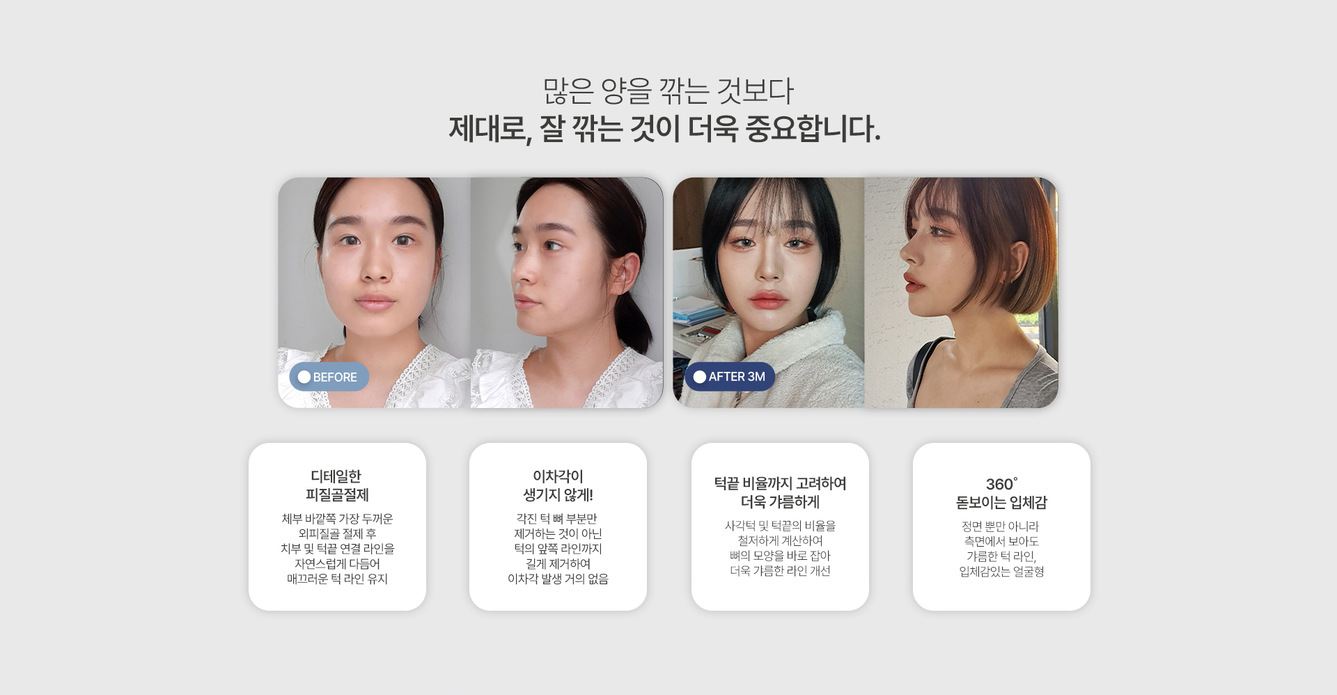 사각턱성형