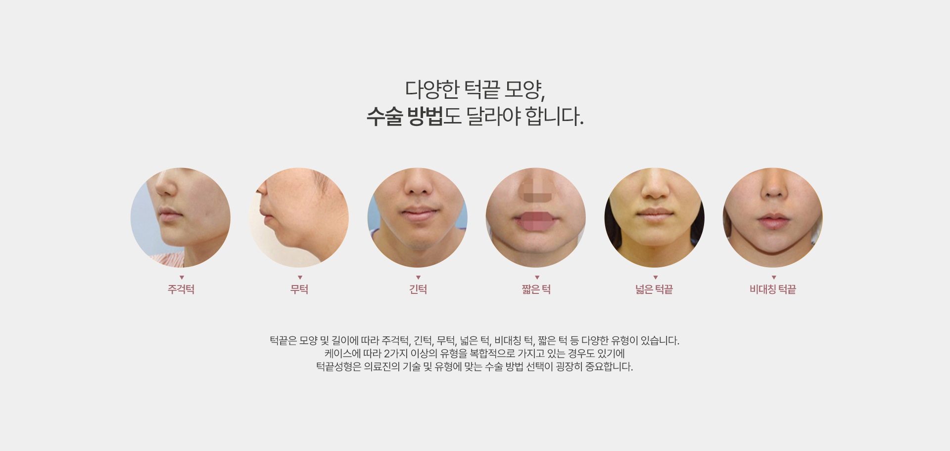 턱끝수술