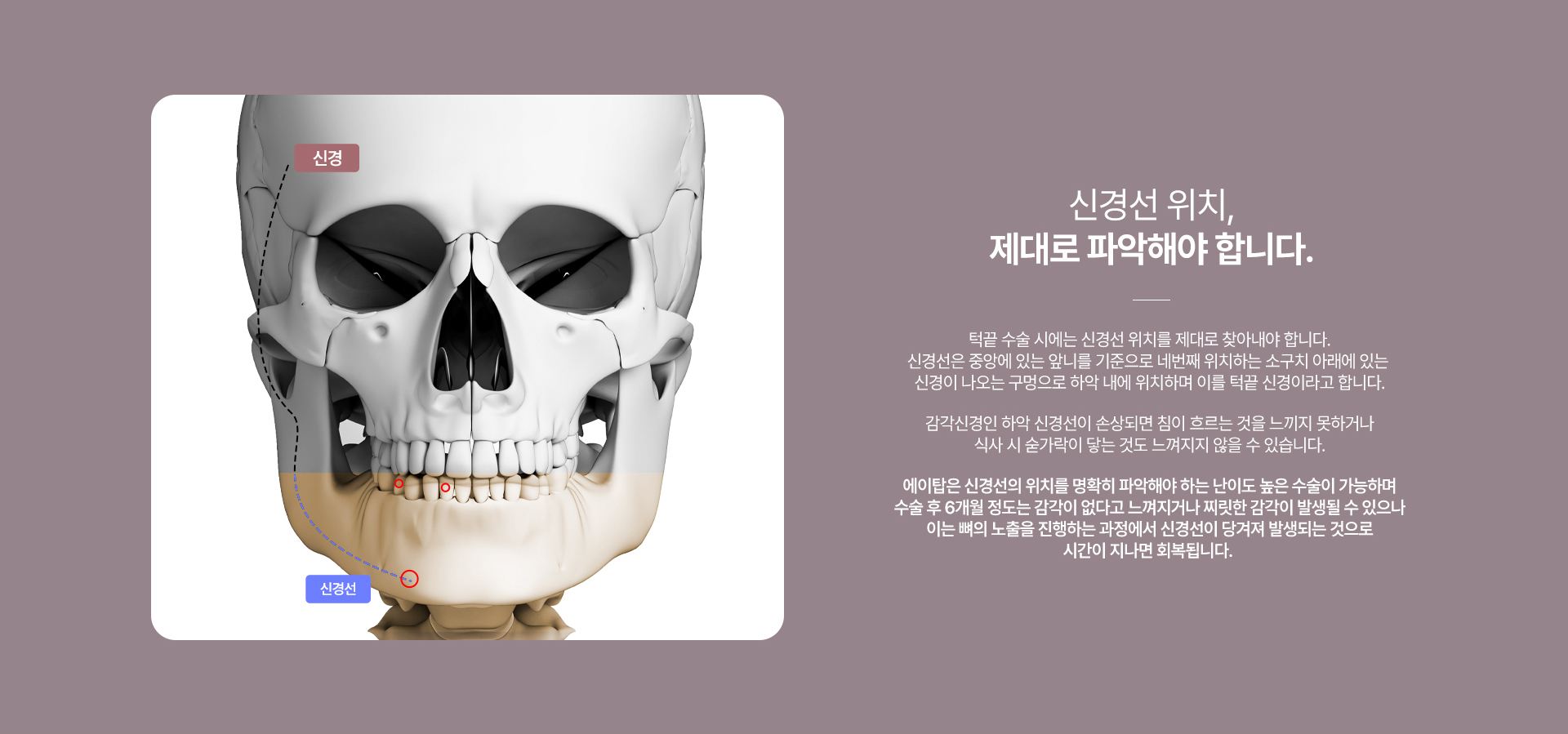 턱끝수술