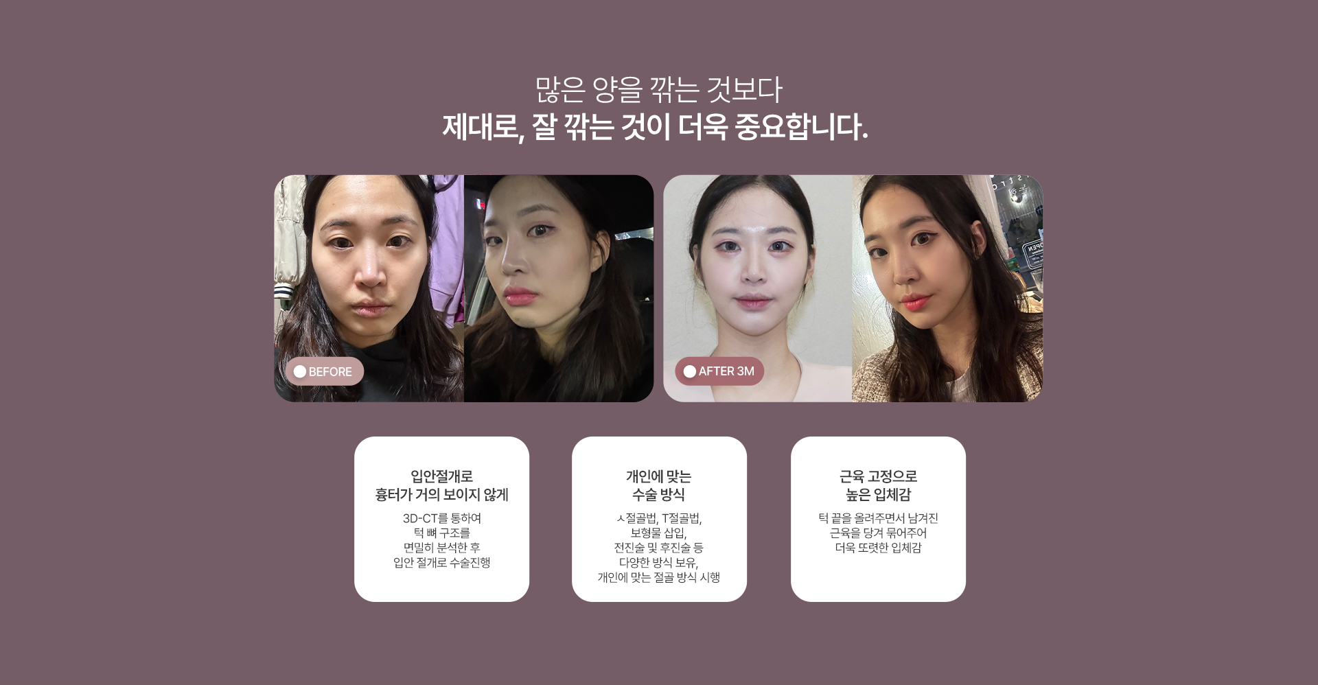 턱끝수술