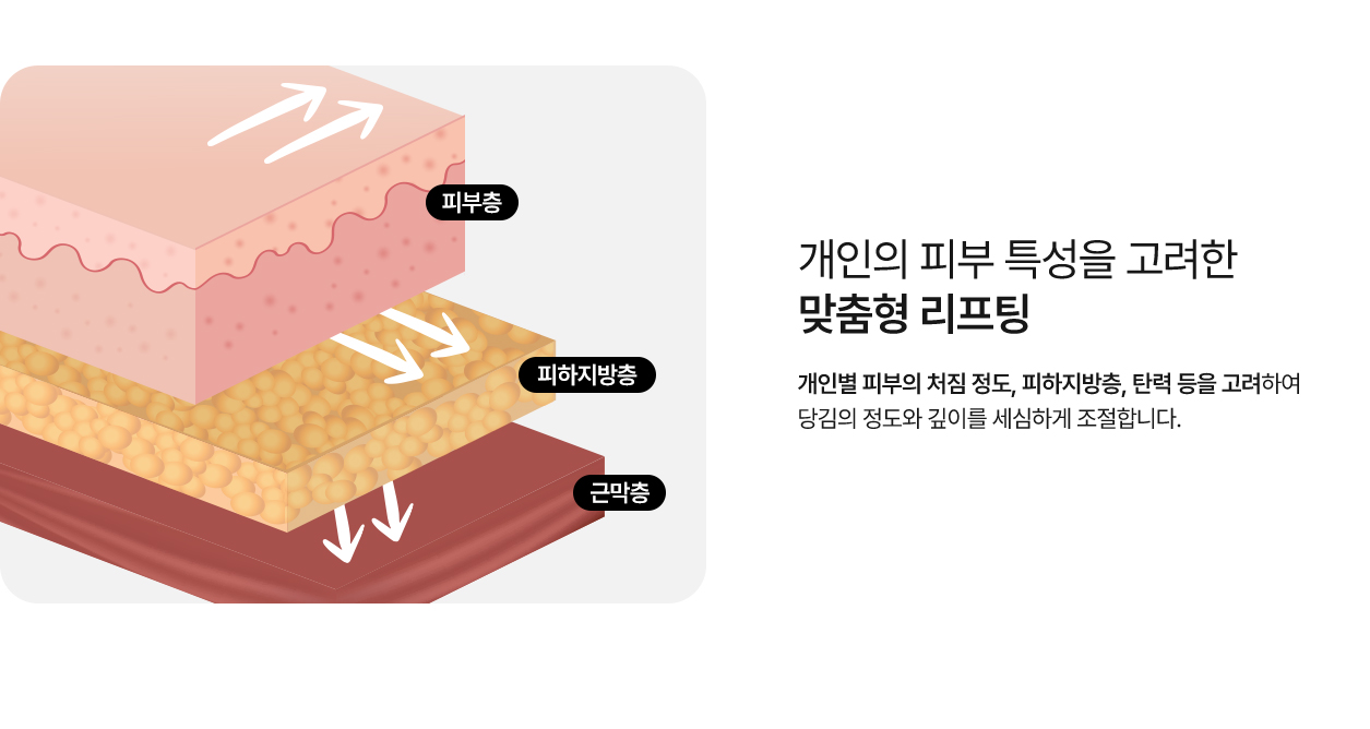 여우리프팅