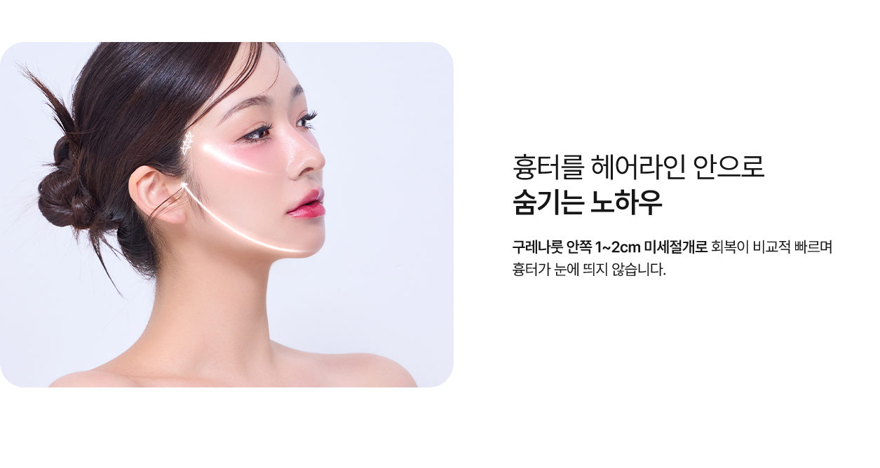 여우리프팅