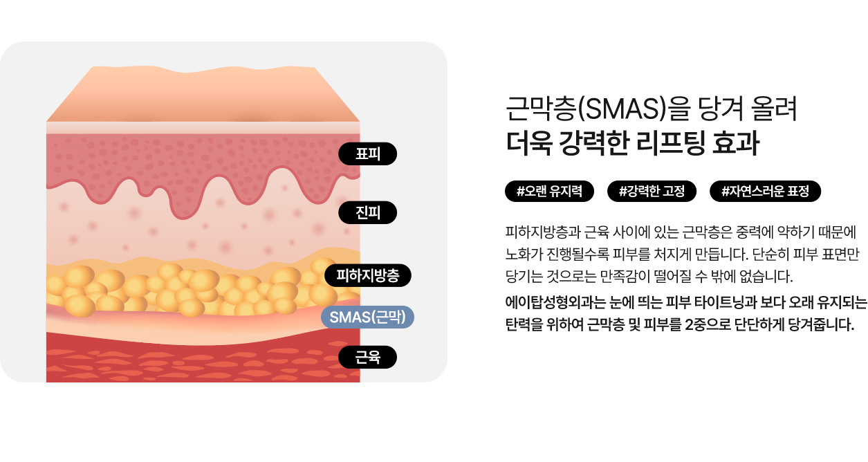 여우리프팅