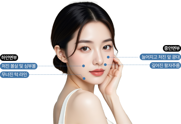 여우리프팅