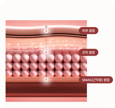 여우리프팅