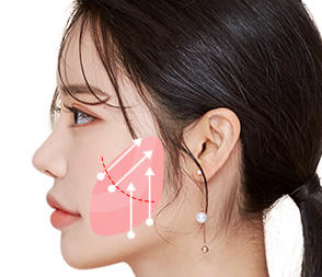 여우리프팅