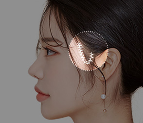 여우리프팅