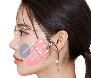 여우리프팅