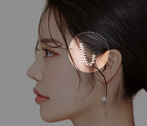 여우리프팅
