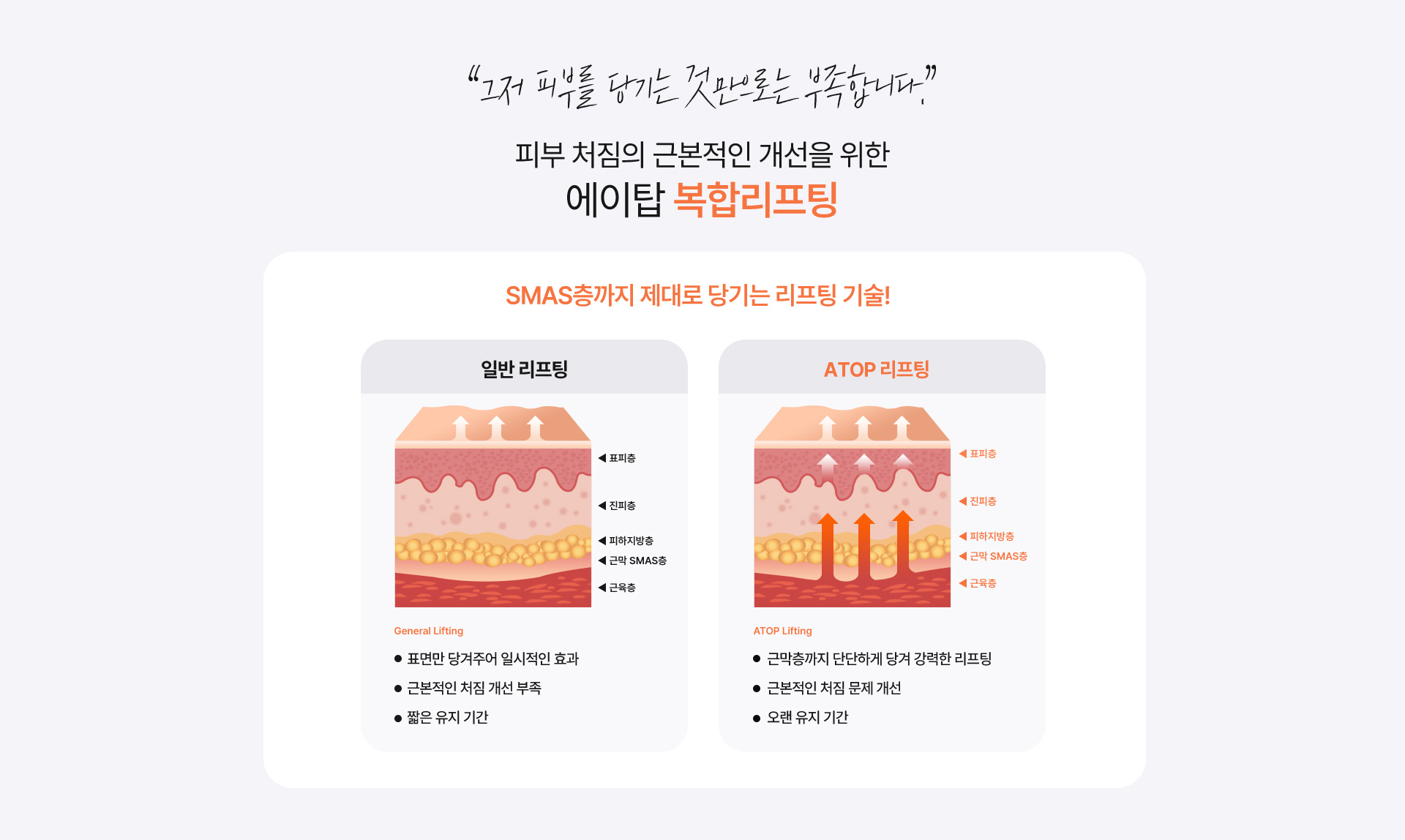올리프팅