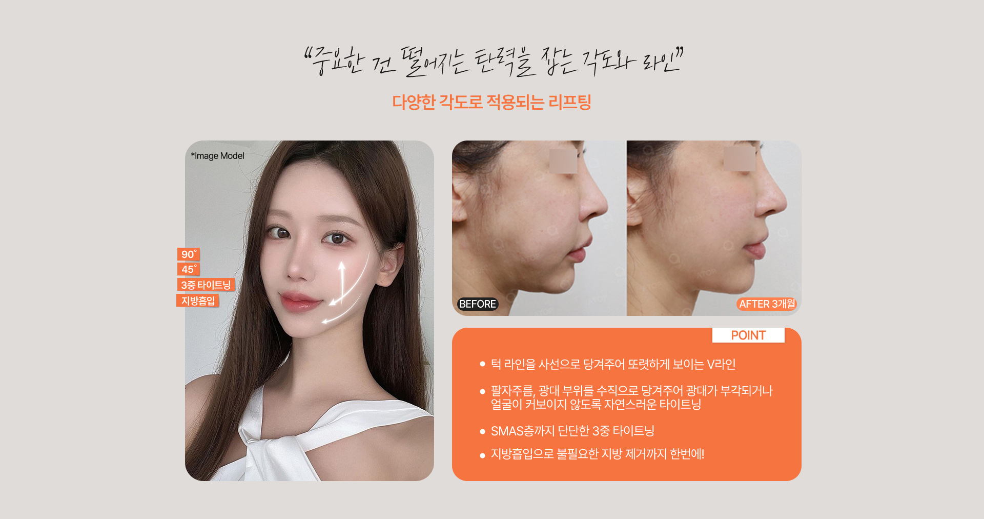 올리프팅