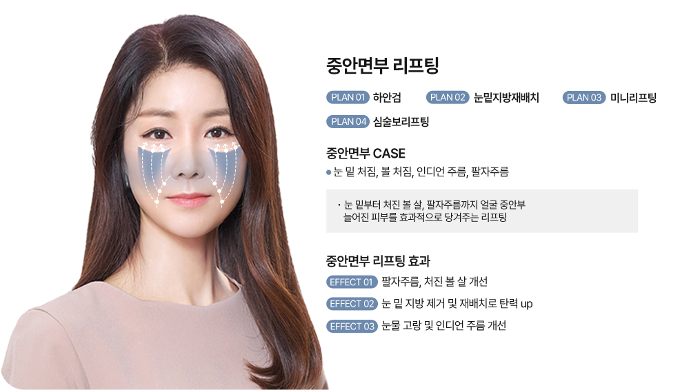 커스텀리프팅