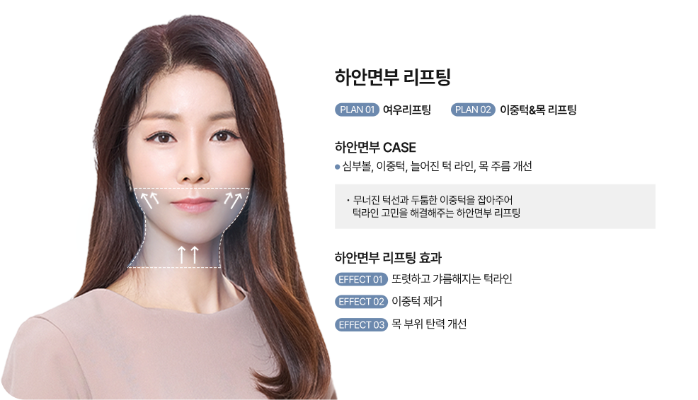커스텀리프팅