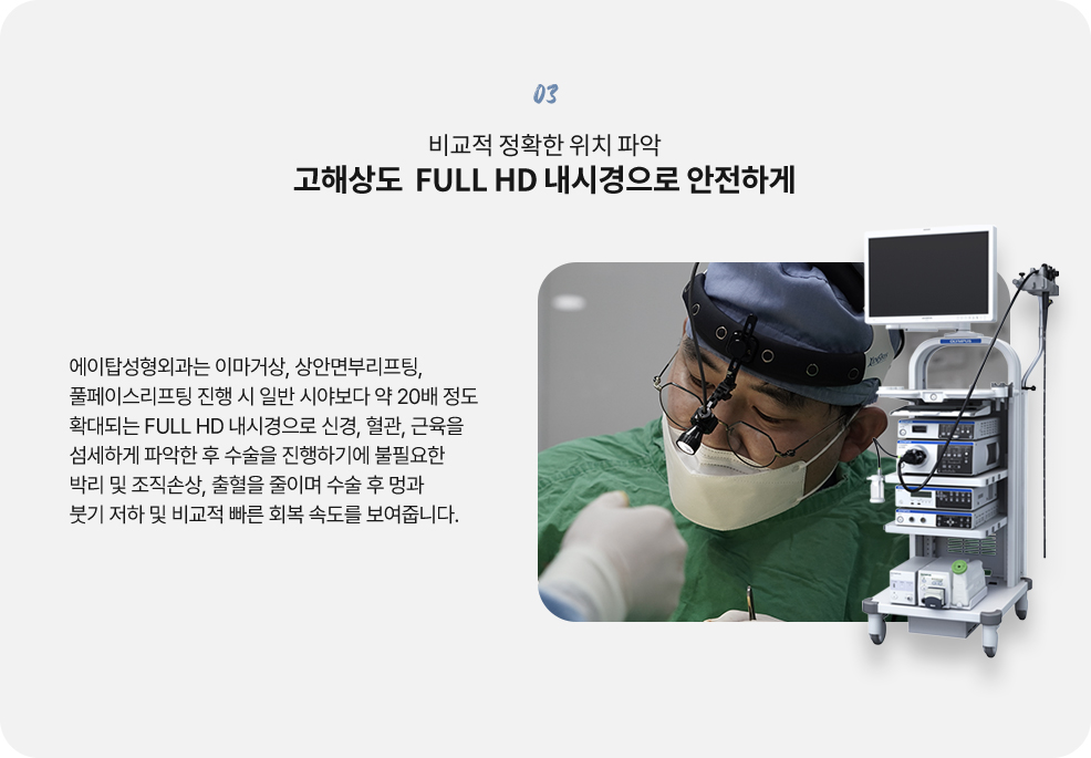 커스텀리프팅