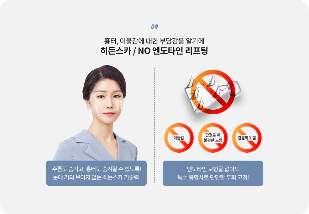 커스텀리프팅