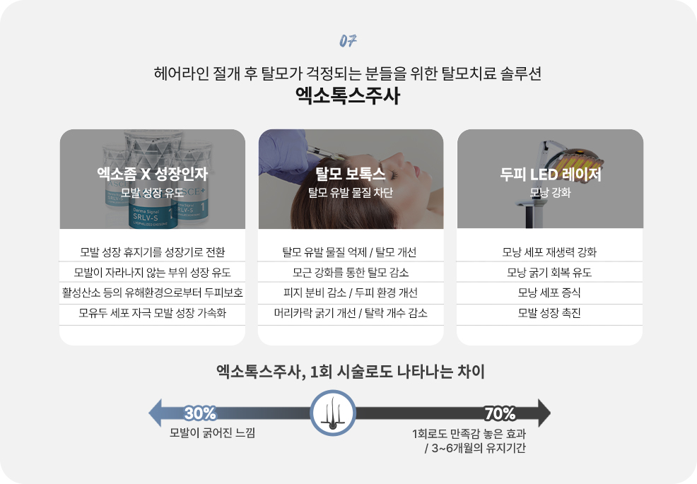 커스텀리프팅