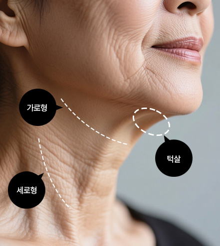 이중턱착붙리프팅
