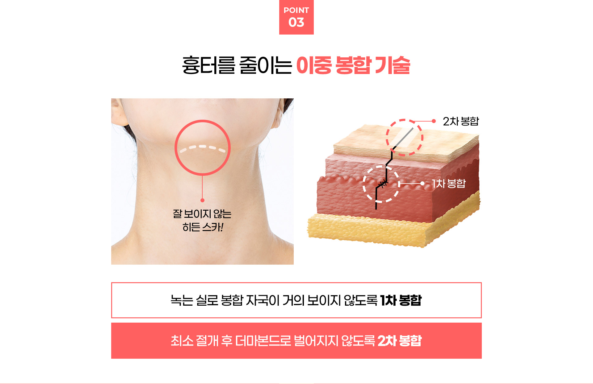 이중턱착붙리프팅