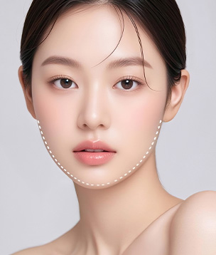 이중턱착붙리프팅