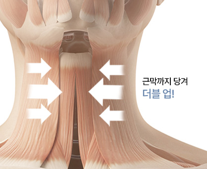 이중턱착붙리프팅