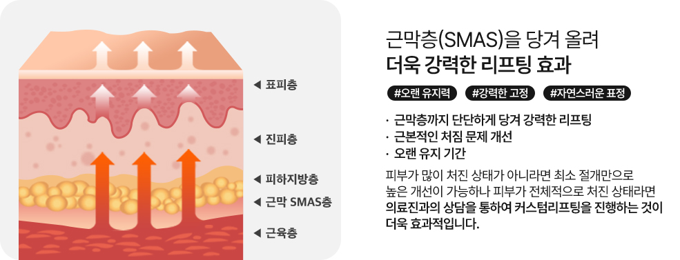 심술보리프팅