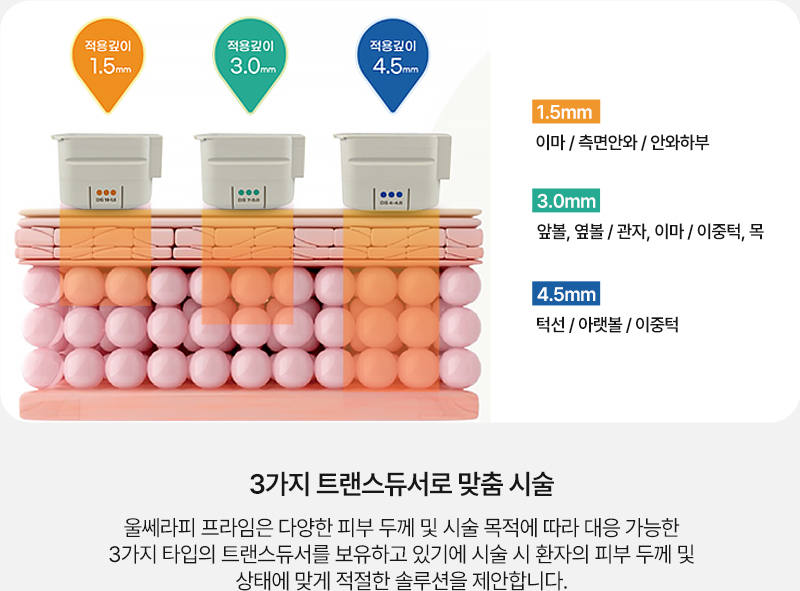 울쎄라리프팅