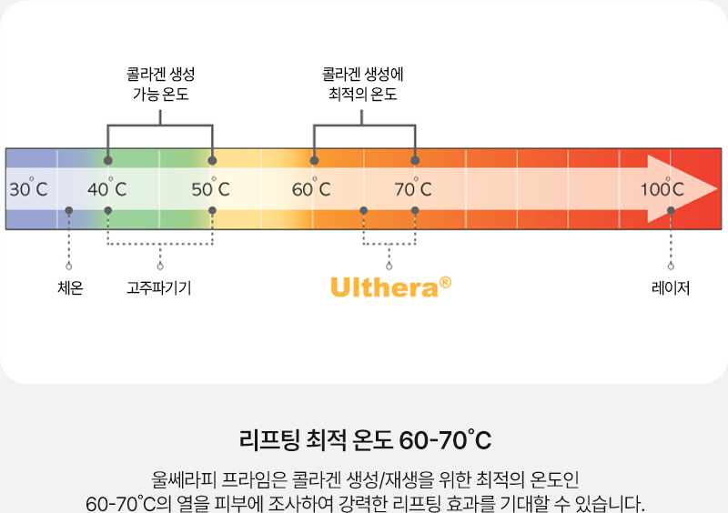 울쎄라리프팅