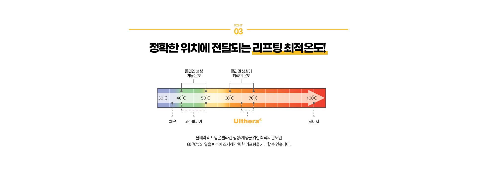 울쎄라리프팅