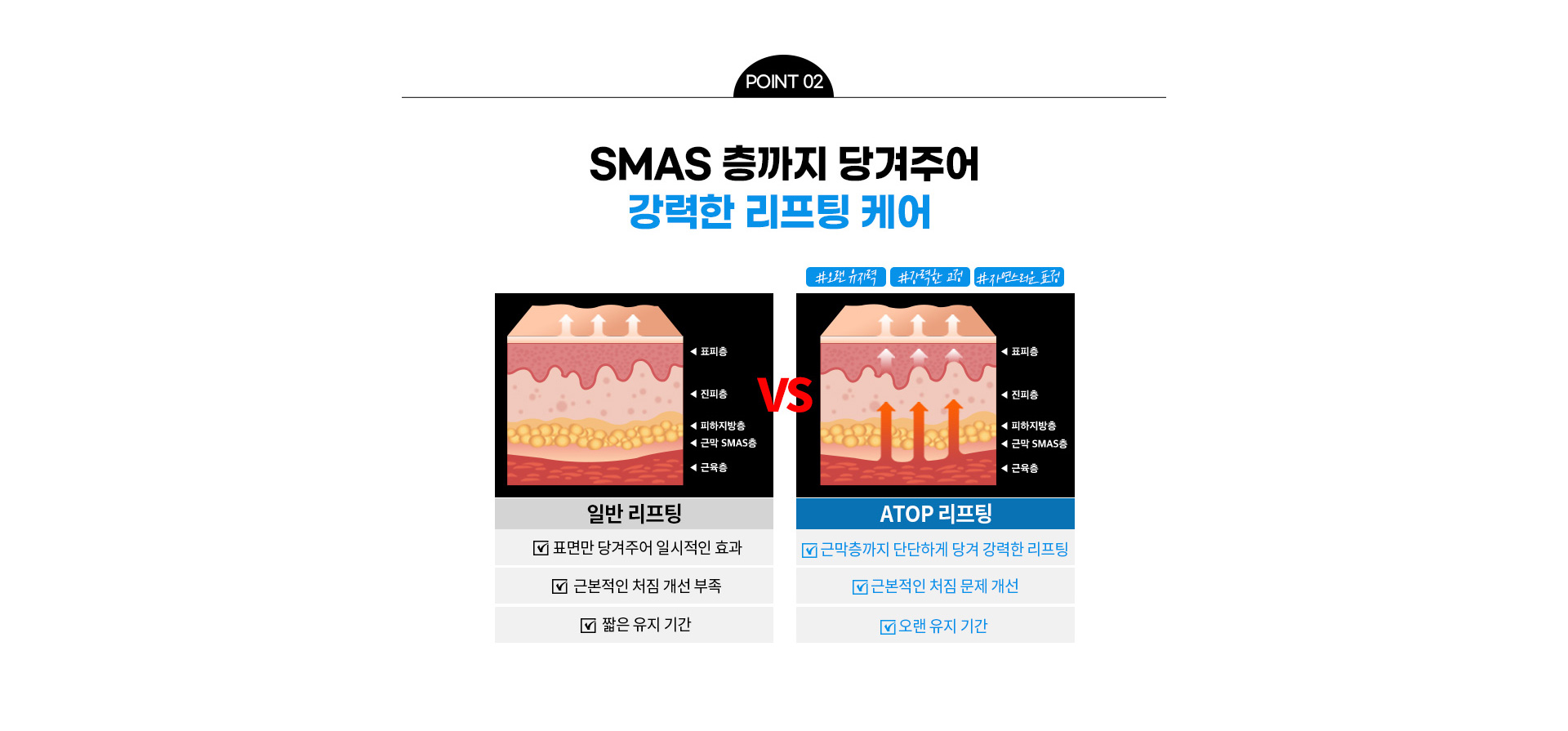 볼처짐 리프팅