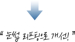 눈썹거상리프팅