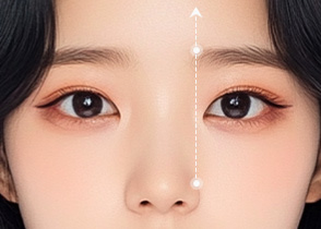 눈썹거상리프팅