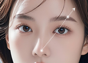 눈썹거상리프팅