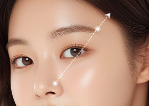 눈썹거상리프팅